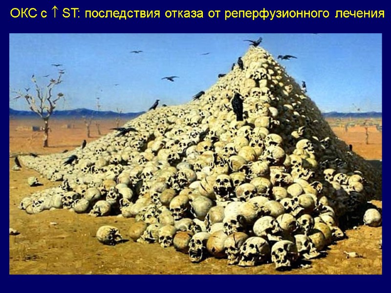 ОКС с  ST: последствия отказа от реперфузионного лечения